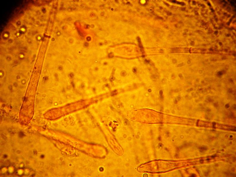 Altra Scutellinia da determinare